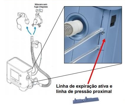 Circuito Pediátrico Ativo com PAP p/ Trilogy 100 - Philips Respironics